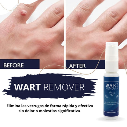 WART Removedor verrugas Premium  ⭐⭐⭐⭐⭐