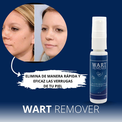 WART Removedor verrugas Premium  ⭐⭐⭐⭐⭐