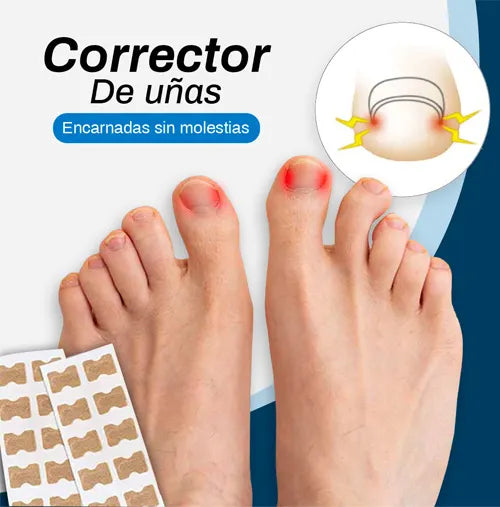 Parches correctores de uñas encarnadas